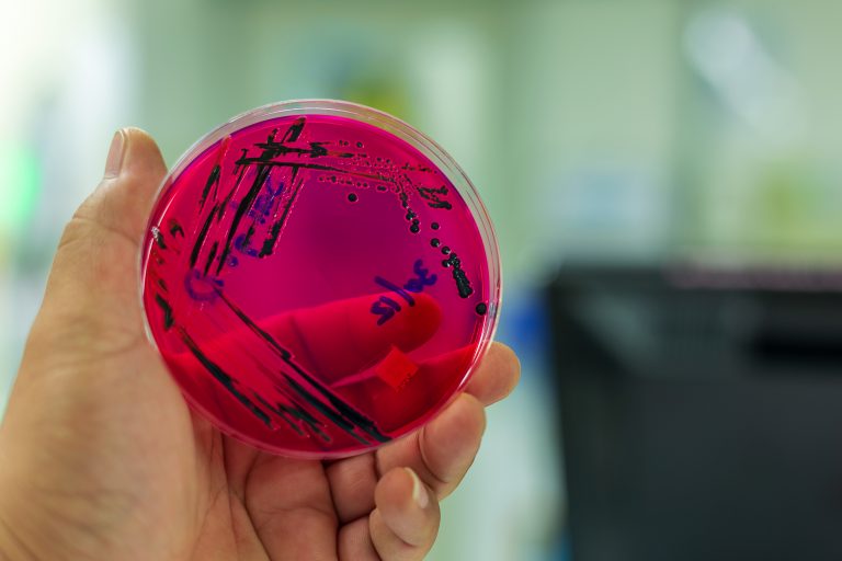 Sepsis: essential information on the UK’s hidden killer