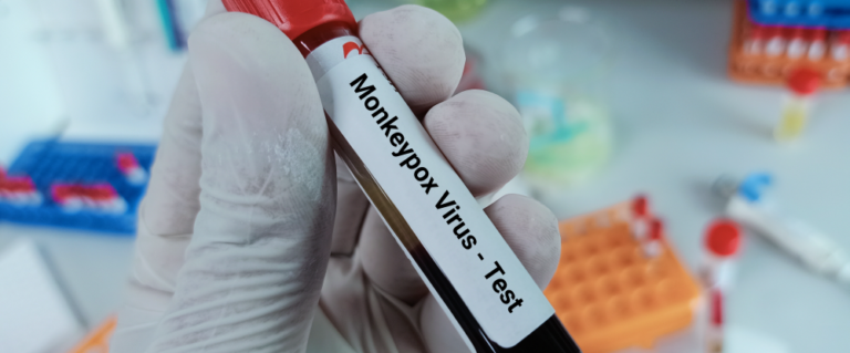 monkey pox
